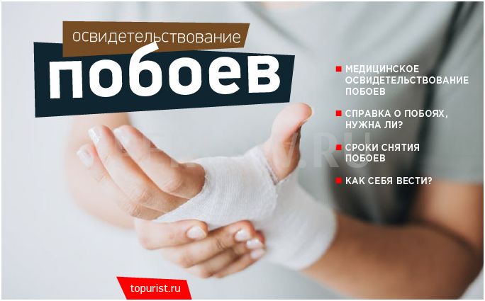 Нужный период. Порядок освидетельствования побоев. Медосвидетельствование о побоях. Снятие побоев сроки.